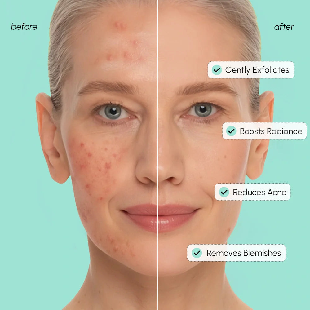 Azelaic Acid Soothing Pads | Radiance-Boosting Toner Pads for Even Skin Tone